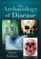The Archaeology of Disease.jpg