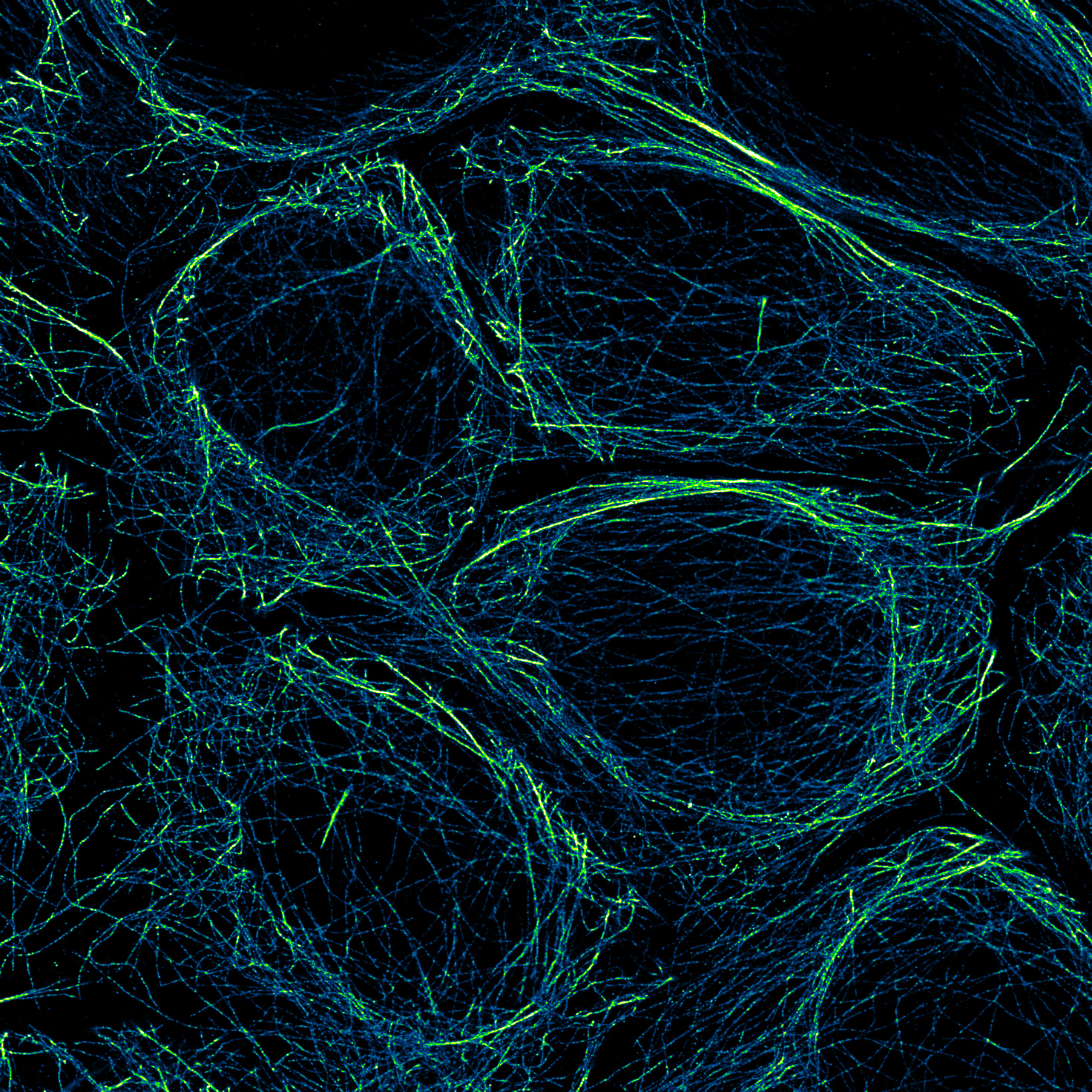 October 2021 - Flinois - Apical microtubule network.jpg