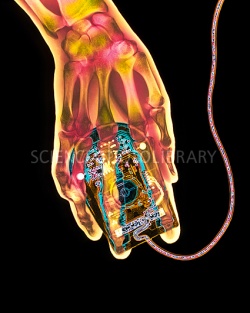 T4150109-Coloured_X-ray_of_a_computer_mouse_and_hu-SPL.jpg