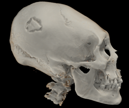 thumbnail_3D reconstruction.png