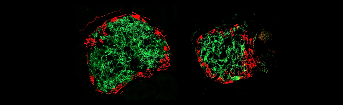 77 Diabète-1200.jpg