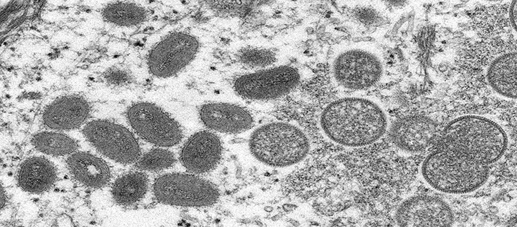 c0524490-monkeypox_virus_particles_tem_1WEB.jpg