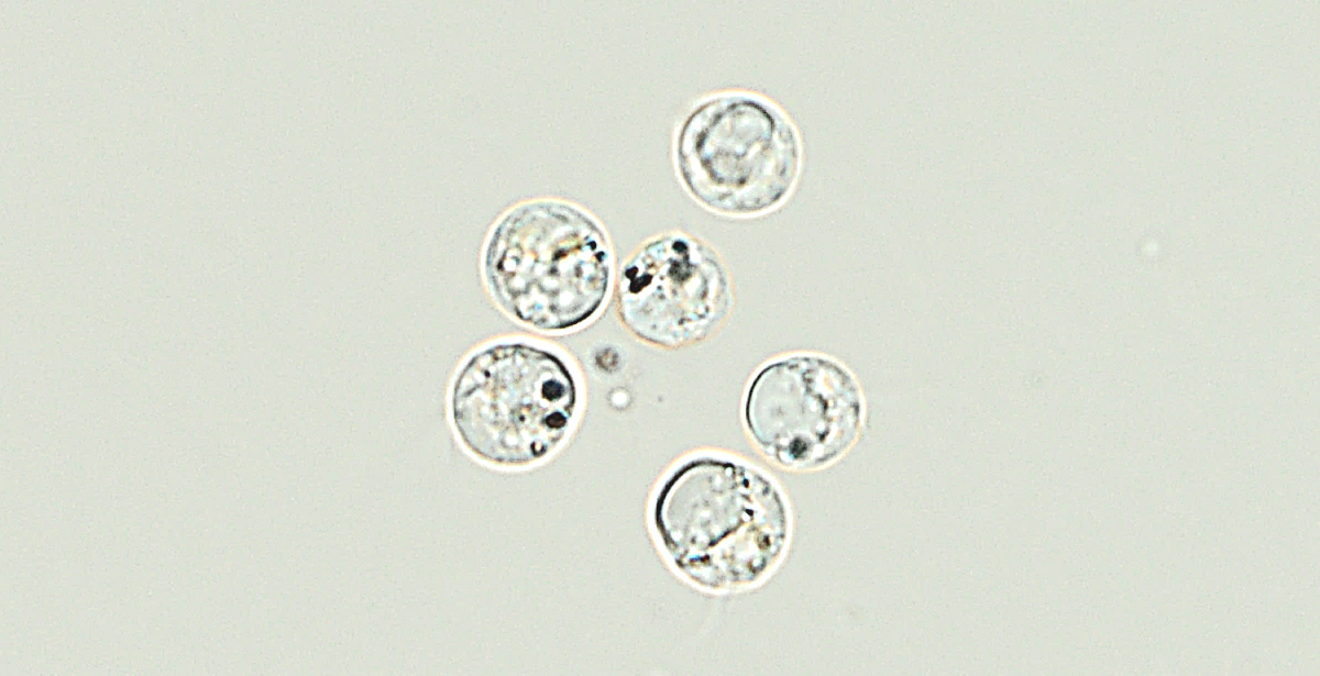 Poterioochromonas malhamensis 1200px.jpg