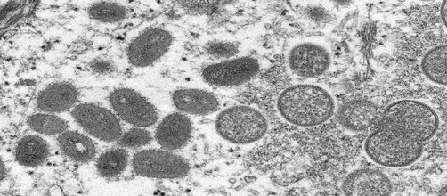 c0524490-monkeypox_virus_particles_tem_1WEB.jpg
