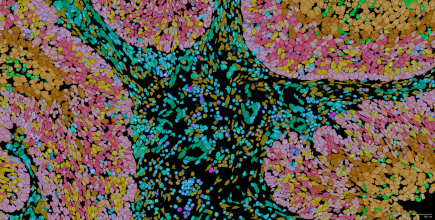 09.03.2026 illustration NL56_mars26_Oncologie_CRTOH_FR.docx.jpg