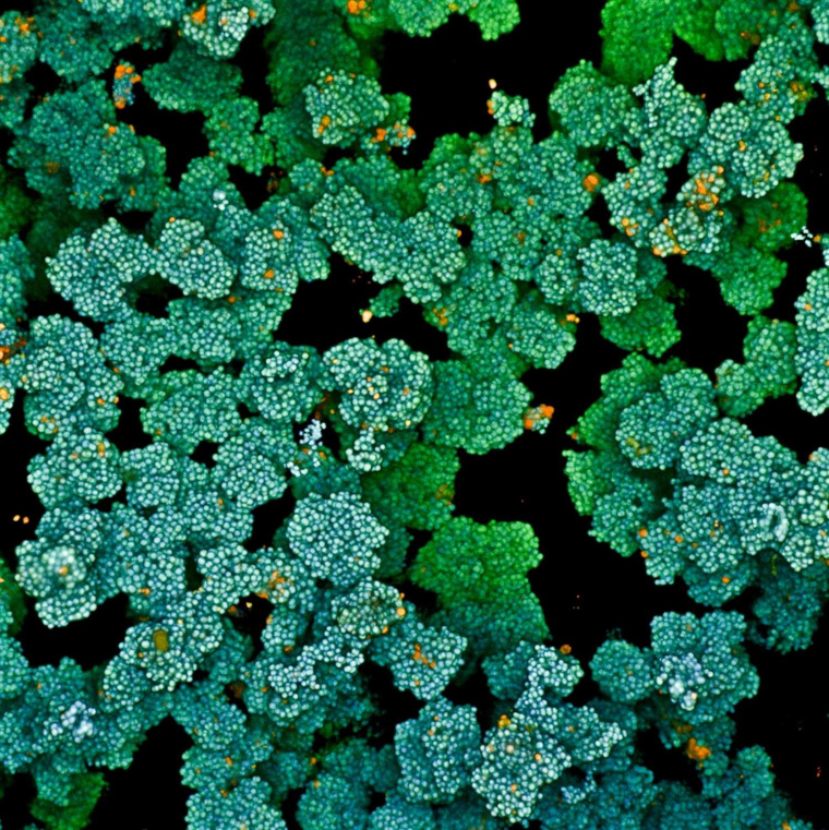 Bacterial biofilm.jpg