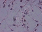 SpermatozoidesPapanicolaou.jpg