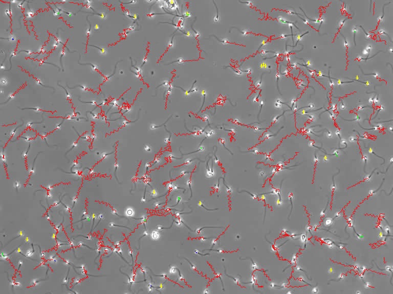 SpermatozoidesCASA.jpg