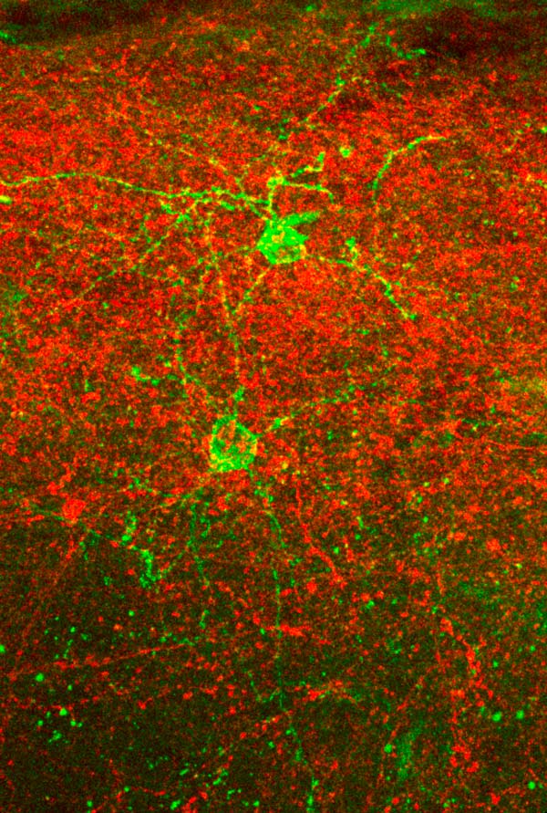Neurogliaform-cell_web.jpgNeurogliaform cells (NGCs, green) and axons from the posteriomedial thalamus (red), expressing different light-activated ion channels, in barrel cortex layer 1. This combination allows for selective optogenetic activation of the 