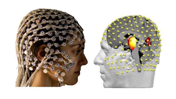 Ch-Michel EEG-2.jpg