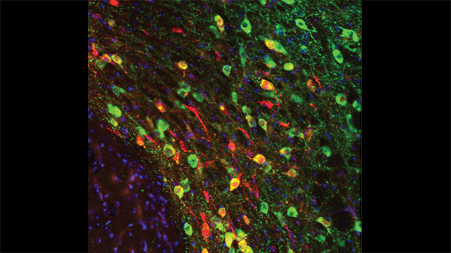 Bellone dopamine-web2.jpg