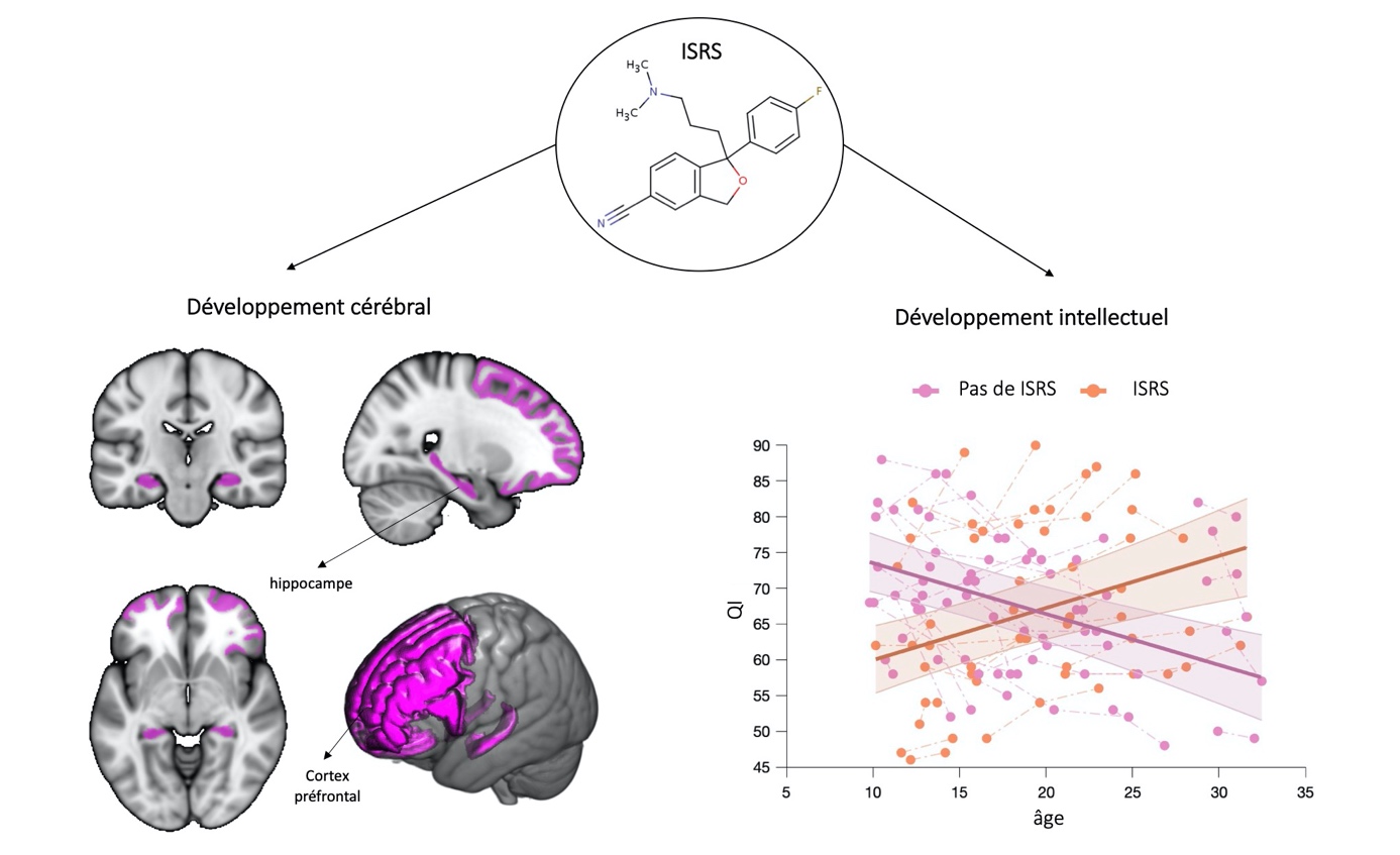 Effects of SSRIs on brain and intellectual development. on the left side: brain map showing regions of the brain protected by the prolonged administration of SSRIs comprising a network of prefrontal and limbic sructures. On the right side: plot displaying