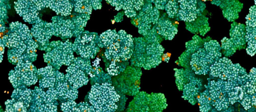 WEB_Bacterial biofilm.jpg