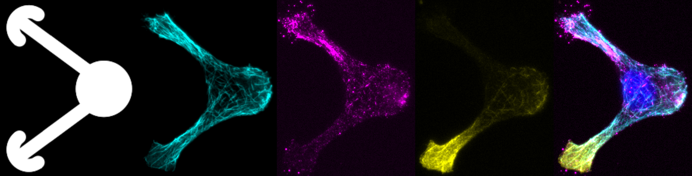 Hela_neuron-like_K560_alphaTub_AcTub_Nucleus_2.png