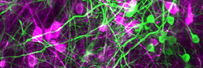 mitral-and-tufted-neurons_400.jpg