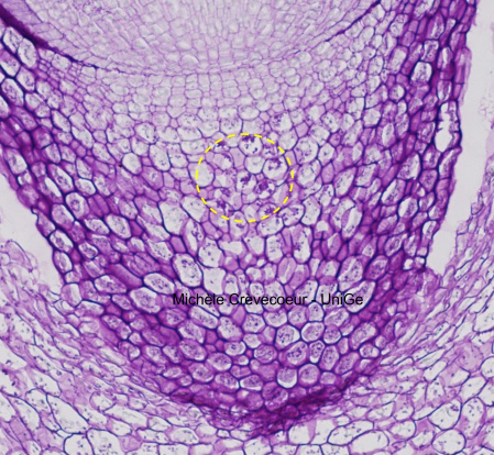 Site PAS - parenchyme coiffe