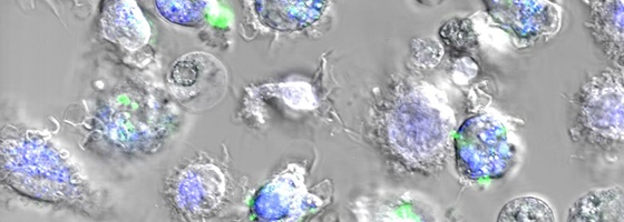 Une méthode révolutionnaire pour sélectionner les nanoparticules les plus utiles en médecine